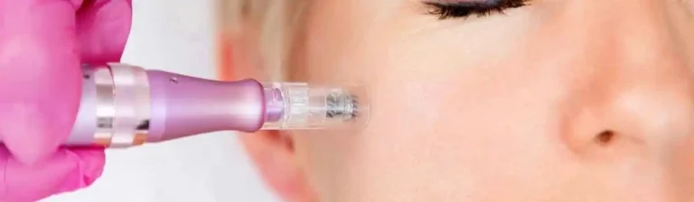 Tratamiento de Dermapeeling en Clínica Reviure